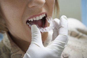 Are Clear Braces For You?