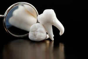 Wisdom Tooth Extraction Is The Most Common Oral Surgery
