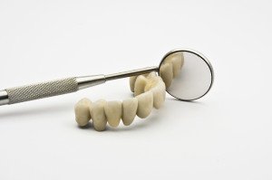 Benefits And Types Of Dental Bridges