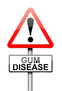 How To Effectively Prevent Periodontal Disease