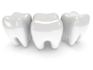 Is Tooth Bonding Right For You?