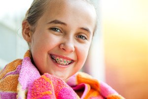 What You Should Know Before You Or Your Child Get Braces