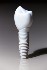 The Primary Advantages And Disadvantages Of Dental Implants