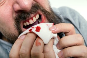 Why Are Your Gums Bleeding?